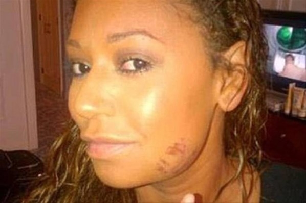 Mel B’nin boşanma davasından sızan şiddet iddiaları 3