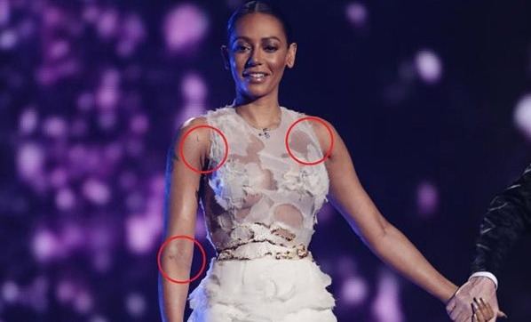 Mel B’nin boşanma davasından sızan şiddet iddiaları 1