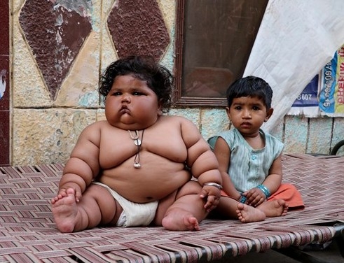 Bu bebek 8 aylık! 4 yaşındaki çocukla aynı kiloda... 9