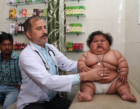 Bu bebek 8 aylık! 4 yaşındaki çocukla aynı kiloda... 7