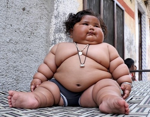 Bu bebek 8 aylık! 4 yaşındaki çocukla aynı kiloda... 14