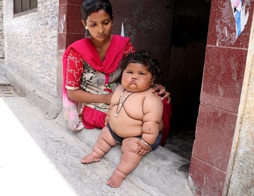 Bu bebek 8 aylık! 4 yaşındaki çocukla aynı kiloda... 8