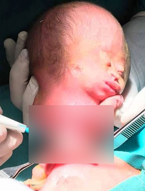 Yeni doğan bebeğin karnından çıkan doktorları şoke etti! 4