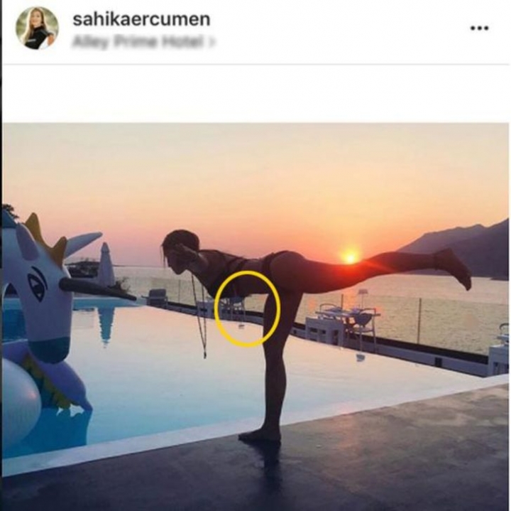 Ünlülerin sosyal medyada fotoğraflarına uyguladıkları göze batan Photoshop hataları! 16