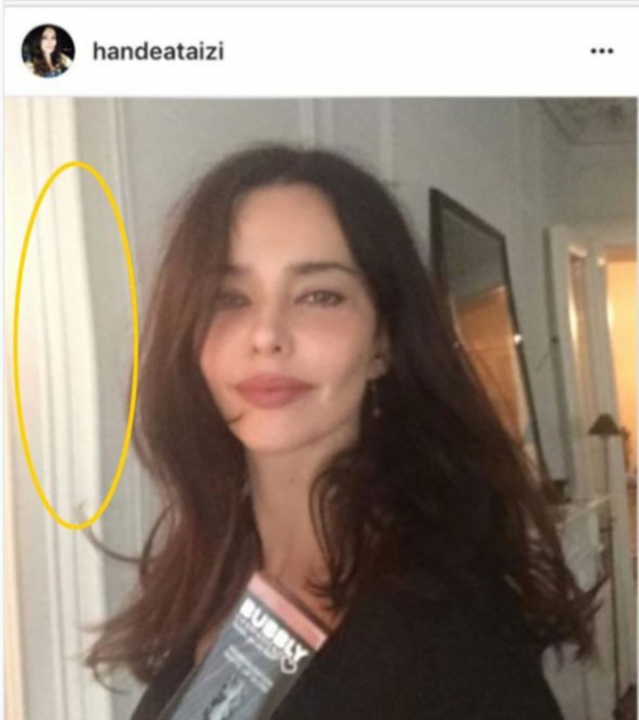 Ünlülerin sosyal medyada fotoğraflarına uyguladıkları göze batan Photoshop hataları! 11