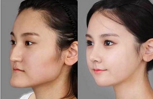 Korelilerin estetik çılgınlığı sonucu büyük değişimleri! 20