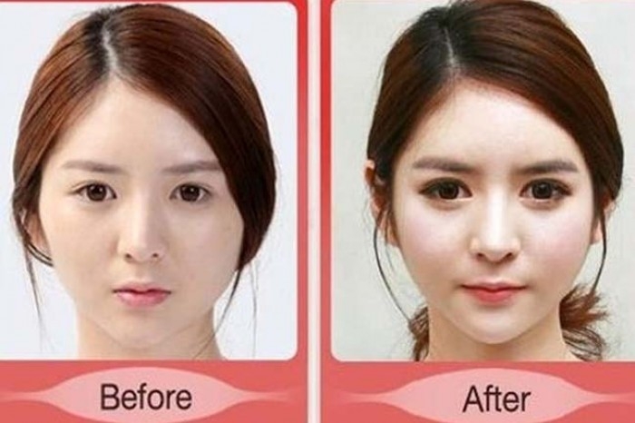 Korelilerin estetik çılgınlığı sonucu büyük değişimleri! 9
