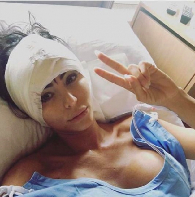 'Çirkin' diyorlar diye kendini baştan yarattı... İşte yaşadığı inanılmaz değişim! 5