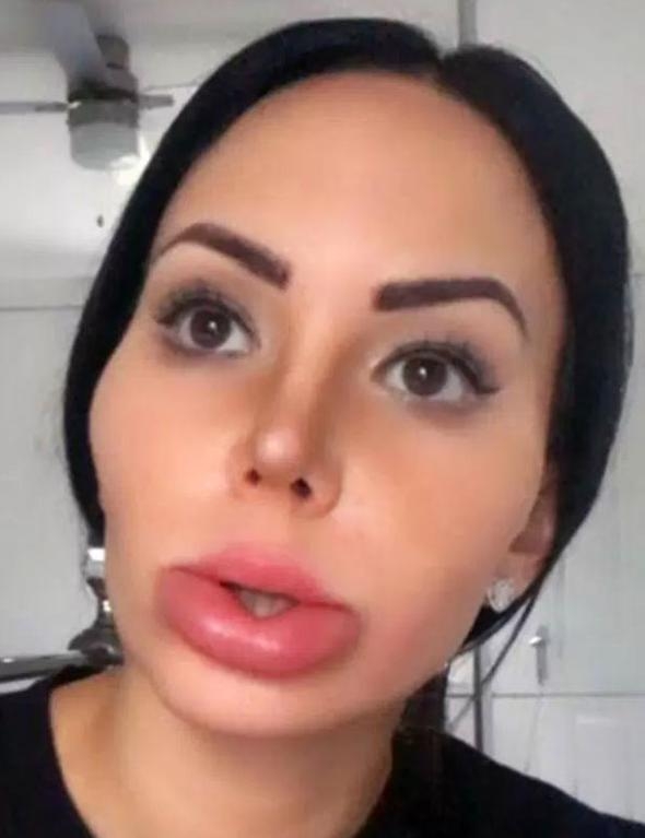 'Çirkin' diyorlar diye kendini baştan yarattı... İşte yaşadığı inanılmaz değişim! 21