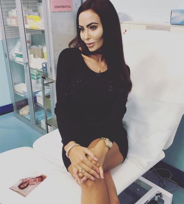 'Çirkin' diyorlar diye kendini baştan yarattı... İşte yaşadığı inanılmaz değişim! 17