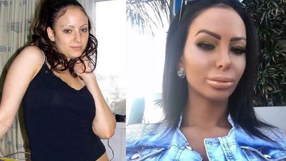 'Çirkin' diyorlar diye kendini baştan yarattı... İşte yaşadığı inanılmaz değişim! 23