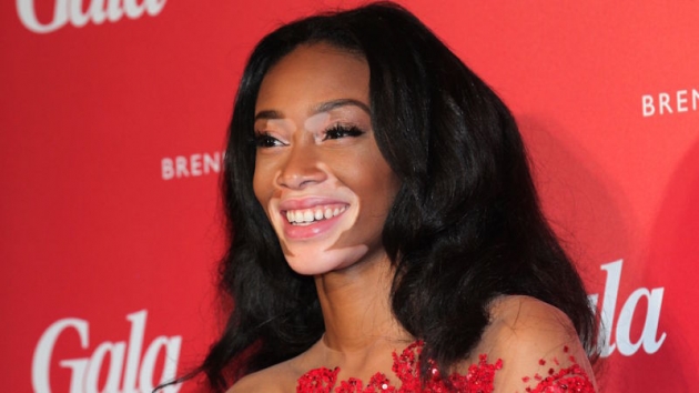 Vitiligo hastası iki renkli manken, özgüveniyle kendine hayran bırakıyor! 4