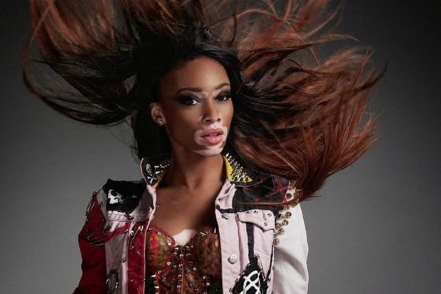 Vitiligo hastası iki renkli manken, özgüveniyle kendine hayran bırakıyor! 7