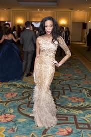 Vitiligo hastası iki renkli manken, özgüveniyle kendine hayran bırakıyor! 15