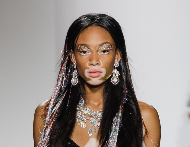 Vitiligo hastası iki renkli manken, özgüveniyle kendine hayran bırakıyor! 37