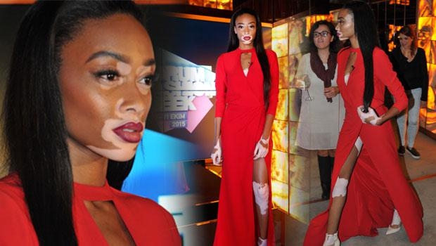 Vitiligo hastası iki renkli manken, özgüveniyle kendine hayran bırakıyor! 66
