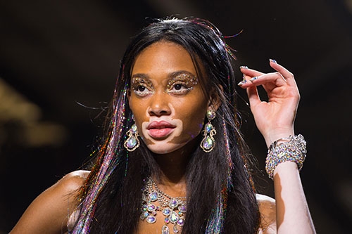 Vitiligo hastası iki renkli manken, özgüveniyle kendine hayran bırakıyor! 62