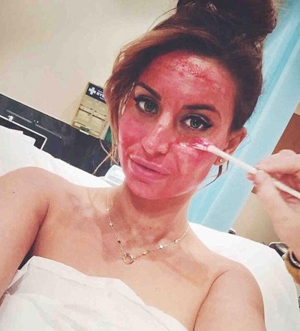 Kim Kardashian'ın öncülük ettiği bu gençlik formülü göz korkutuyor! 6