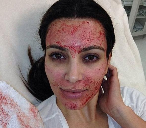 Kim Kardashian'ın öncülük ettiği bu gençlik formülü göz korkutuyor! 5