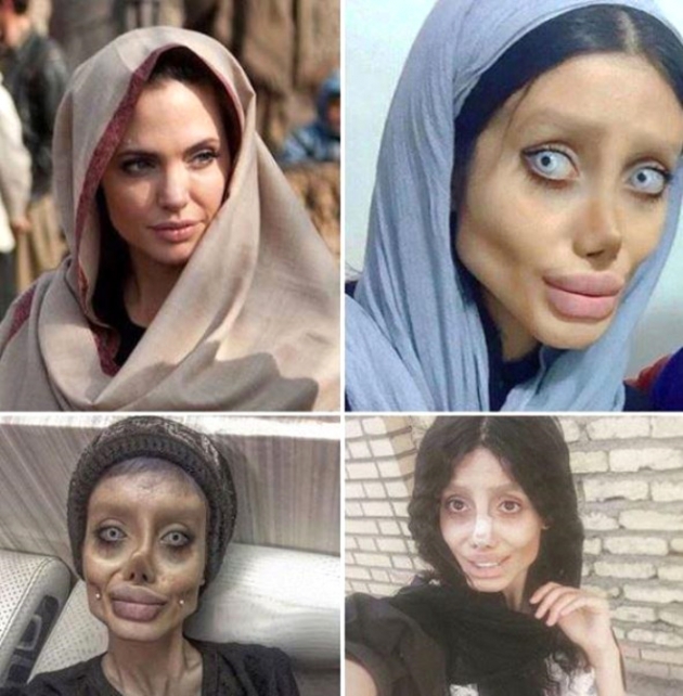 Angelina Jolie'ye benzemek için estetik oldum demişti! 11