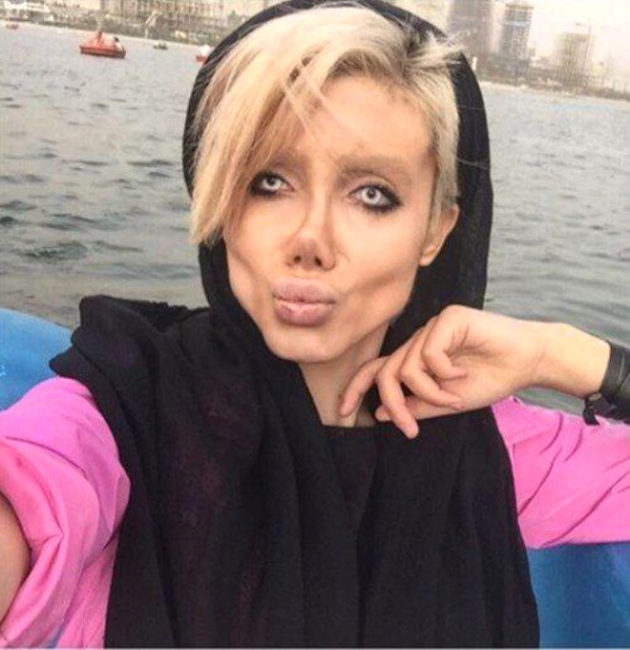 Angelina Jolie'ye benzemek için estetik oldum demişti! 9