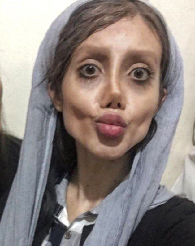Angelina Jolie'ye benzemek için estetik oldum demişti! 6