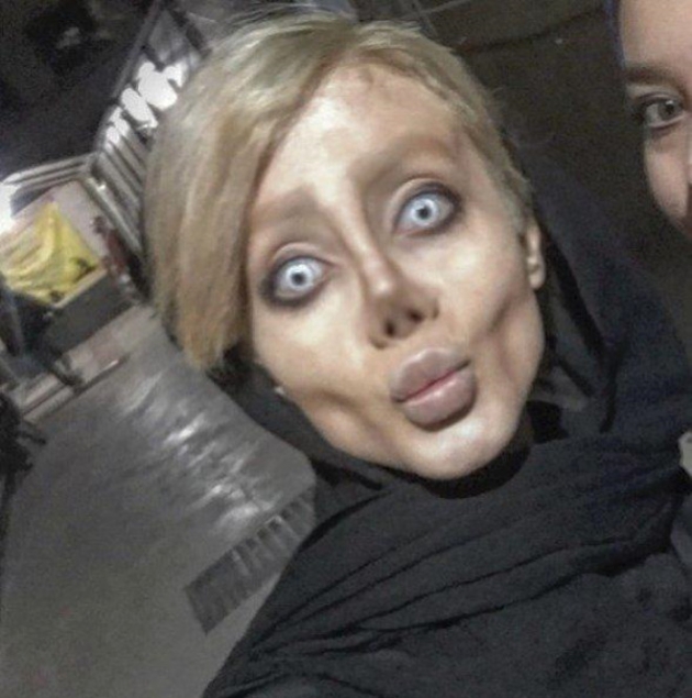 Angelina Jolie'ye benzemek için estetik oldum demişti! 7