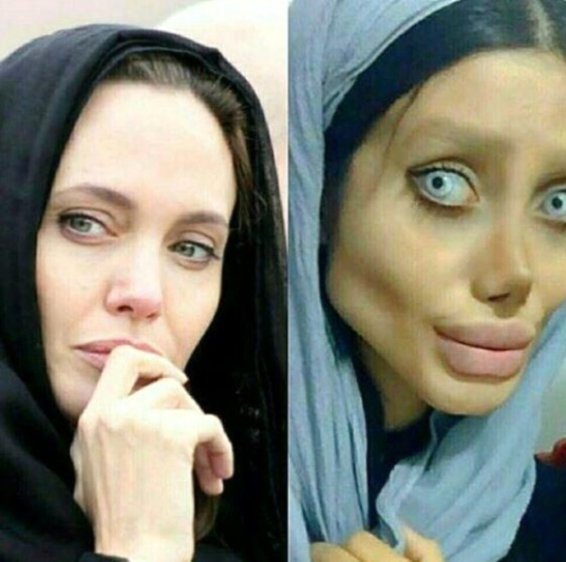 Angelina Jolie'ye benzemek için estetik oldum demişti! 12