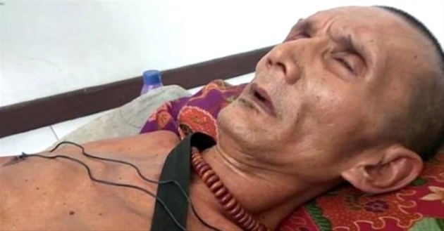 Geçirdiği kaza sonrası vücudu taşlaştı! 9