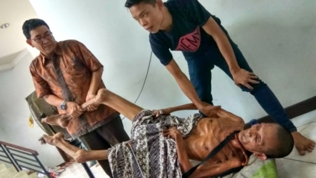 Geçirdiği kaza sonrası vücudu taşlaştı! 3