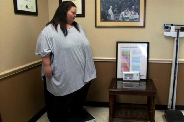 243 kilo verdi! Son hali inanılmaz 5