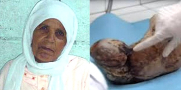 Doğumdan korktu, bebeğini 50 yıl doğurmadı! 2