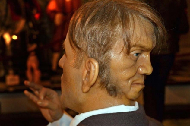 İki yüzlü doğan adam bu acıya dayanamadı! 6