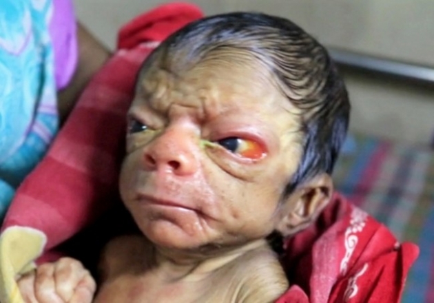 İşte gerçek Benjamin Button! 2
