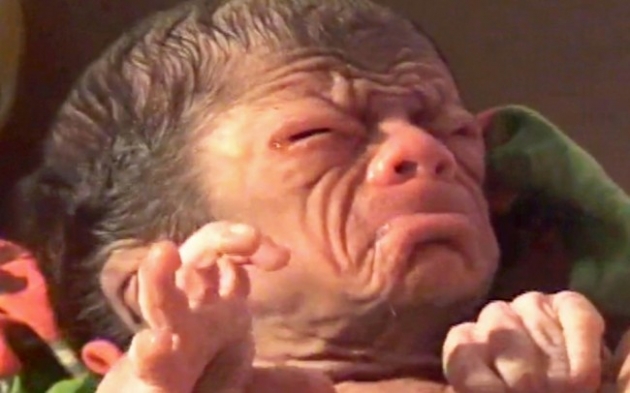 İşte gerçek Benjamin Button! 3
