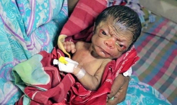 İşte gerçek Benjamin Button! 4