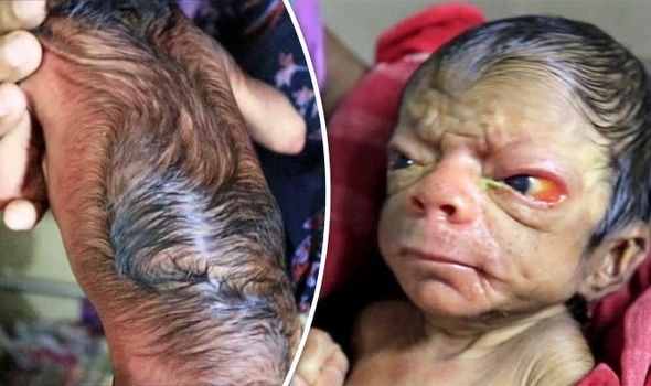 İşte gerçek Benjamin Button! 5
