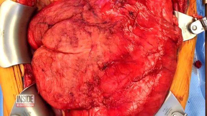 Kilo aldığını sanıyordu, midesinden bu çıktı! 4