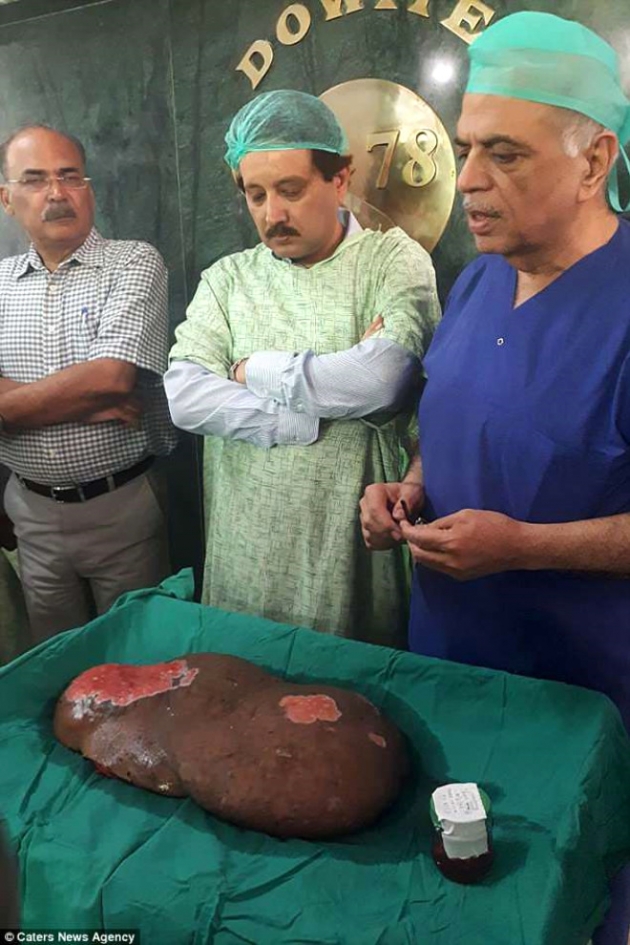 Bacağındaki tümör onu bu hale getirdi! 5