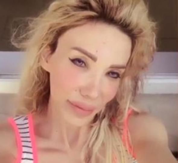 Skandal görüntülerinden sonra Esra Ersoy konuştu! 1