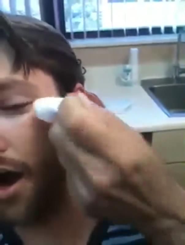 Yüzünden çıkanı görünce inanamayacaksınız! 11