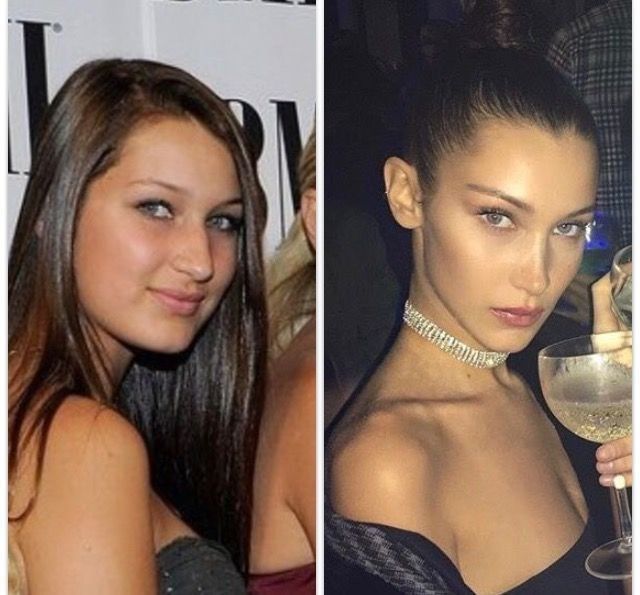Bella Hadid'den şaşırtıcı itiraflar! 5