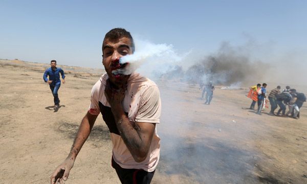 Filistinli genci gaz fişeği ile yüzünden vurdular! 1