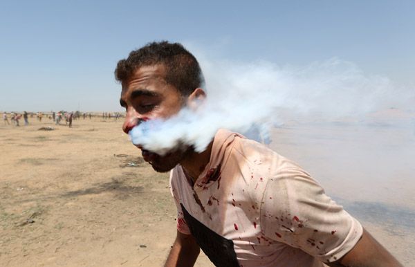 Filistinli genci gaz fişeği ile yüzünden vurdular! 2