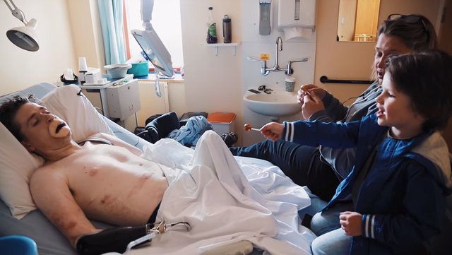 Et yiyen bakteri yüzünden uzuvlarını kaybetti! 12