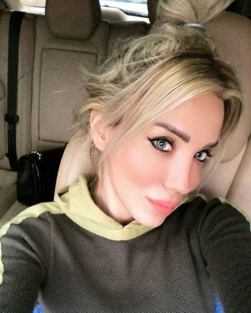 Ciciş Esra estetik yaptırdı, bambaşka biri oldu! 2