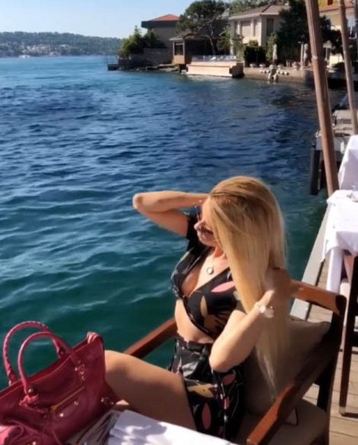 Ciciş Esra estetik yaptırdı, bambaşka biri oldu! 13