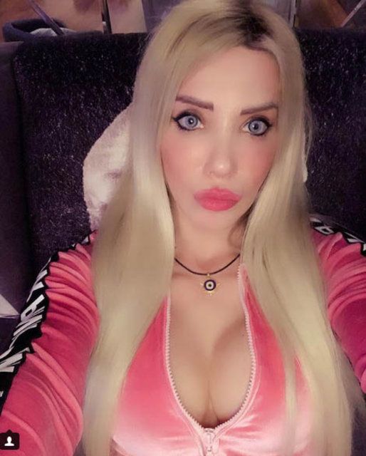 Ciciş Esra estetik yaptırdı, bambaşka biri oldu! 15