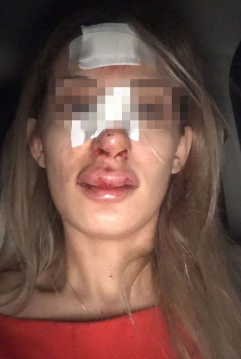 Eski sevgiliye çıplak görüntüler ile şantaj! 3