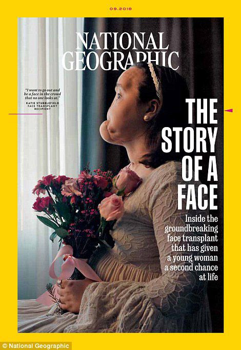 Genç kızın hikayesi National Geographic'e kapak oldu! 4
